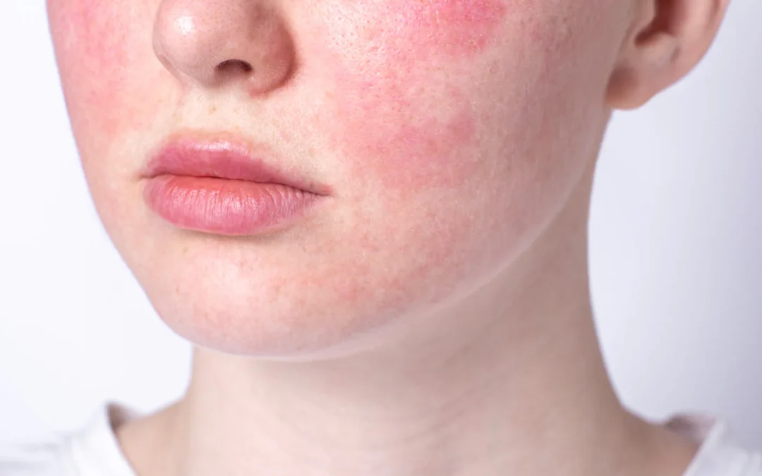 pelle sensibile cosmetica gentile lunabianca latte d asina