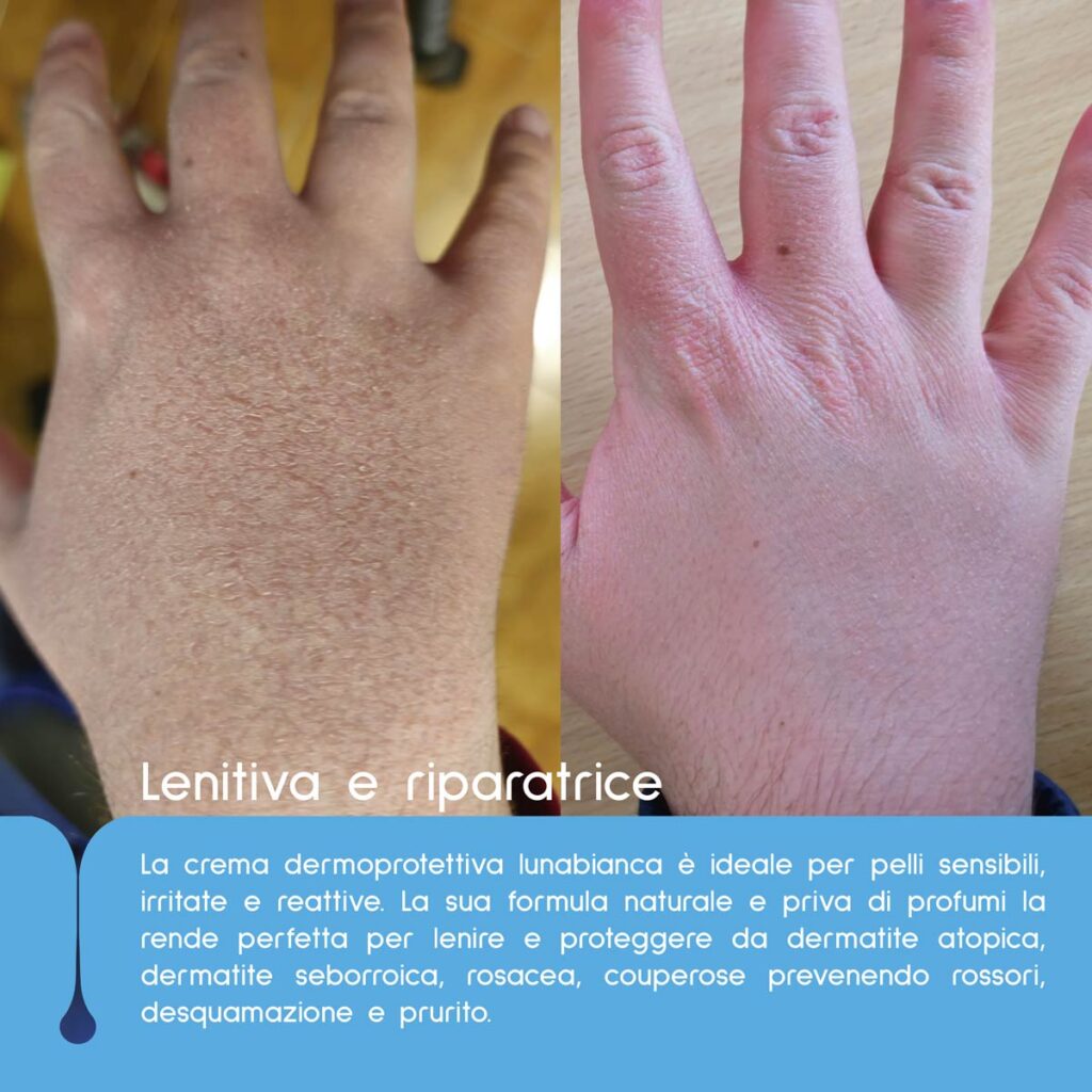 crema mani lunabianca al latte d asina per dermatiti e mani screpolate